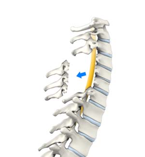 Back & Spine