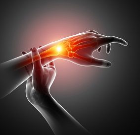 Joint Implant (Wrist, Thumb, Finger)