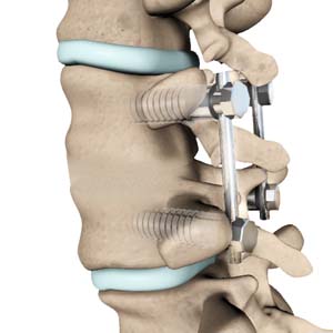 Back & Spine