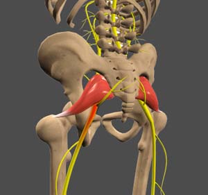 Sciatica: What It Is and How to Treat It