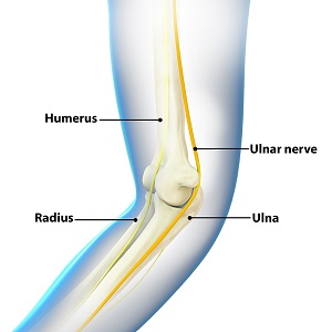 Ulnar Nerve Transposition Madison, WI