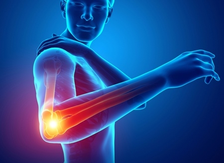 Biceps Tendon Ruptures