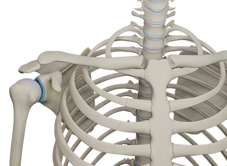 Multidirectional Shoulder Instability